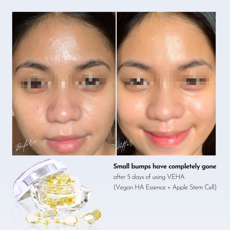 VEHA 1ST TRIAL (10 Days) | Vegan HA Essence + Apple Stem Cell - Hydration, Repair, Anti-aging