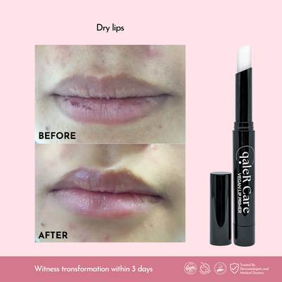 VALUE PACK | Duo Vegan Lip Primer - Instant Moisturizing, Lip Healer, Soothing